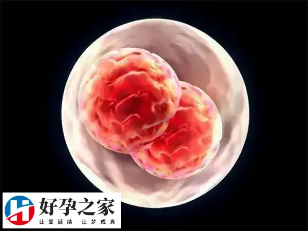 多胎妊娠易导致早产