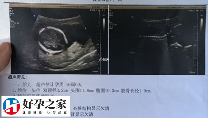 二维双顶径数据看男女方法