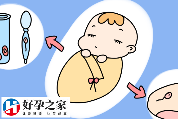 四代试管婴儿优缺点